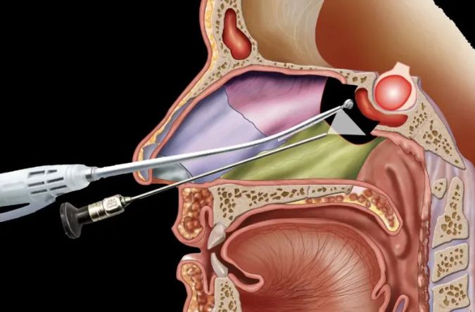 Cranial & Endonasal Surgery